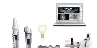 Studio Dentistico Giulia Ferri | Implantologia dentale a Scandiano